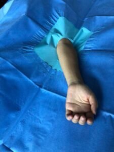 Elbow Drape